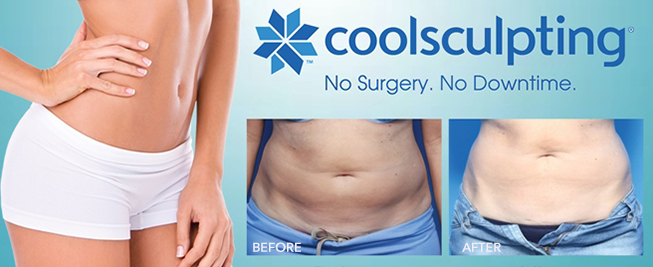 NO SURGERY. NO DOWNTIME  Coolsculpting Rochester New York